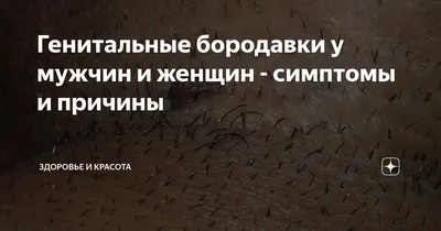 ВПЧ и его клинические проявления, 978-620-6-23356-5, 6206233561  ,9786206233565 by Фернанда Лима де Оливейра, Майара Монтейро, Сорайя Эль  хаким