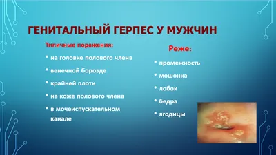 Лечение генитального герпеса в Москве - Честная клиника