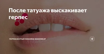 🔴Герпес после татуажа губ После... - permanentmakeupminsk1 | Facebook