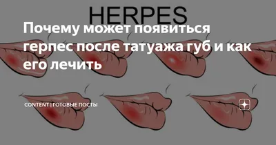 Герпес после татуажа губ что делать - прием противовирусных