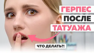 Герпес после татуажа губ. О чем нужно знать заранее. Студия татуажа DUBOVIK  в Краснодаре - YouTube