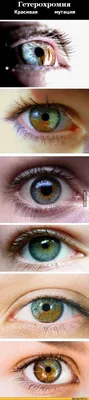 Гетерохромия глаз, разный цвет глаз» — создано в Шедевруме
