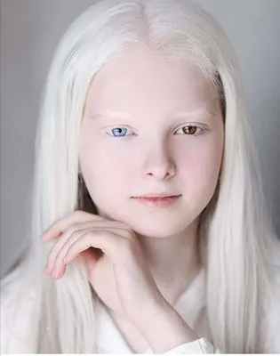 женщина с разными цветами глаз. гетерохромия Стоковое Фото - изображение  насчитывающей глаза, внимательность: 246600530