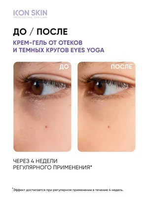 Купить Патчи для глаз IMAGE MD restoring eye masks в официальном  интернет-магазине image-skincare.ru