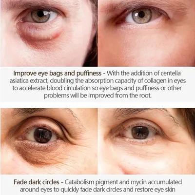Гиалуроновая кислота улучшает темные круги и восстанавливает кожу вокруг  глаз | AliExpress