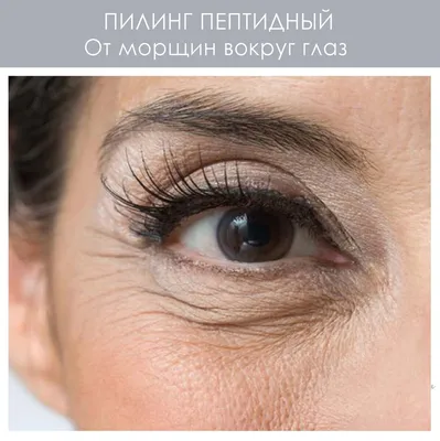 Пептидный пилинг против морщин вокруг глаз | DermaQuest | Дзен