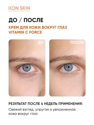 ICON SKIN Крем вокруг глаз от темных кругов с витамином С и пептидом