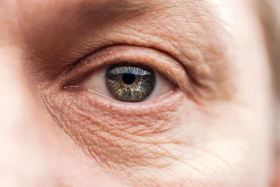 Биоревитализация кожи вокруг глаз в СПб: цена за 1 процедуру,  биоревитализация век в клинике Космед