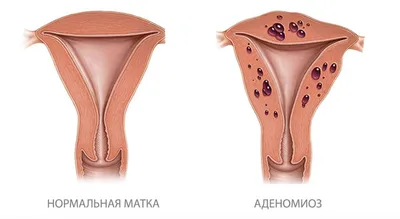 Фото до и после - Лазерная косметология - клиника Seline