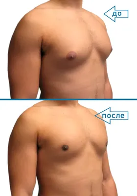 Результаты операций, фото до и после.