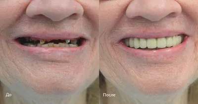 Примеры работ наших стоматологов до и после