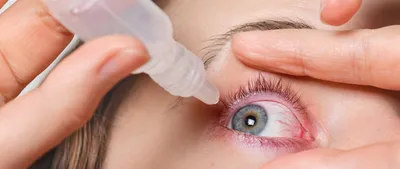Капли для глаз Ядран Галенский Лабораторий АО (Хорватия) Оптинол Тетризолин  - «Капли от красноты глаз. Лучше Визина. Куплены по рекомендации опытного  офтальмолога. » | отзывы