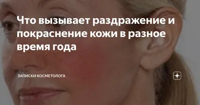 Человек стоит перед зеркалом и воспаление верхнего века Покраснение кожи  вокруг глаз и блефарита Стоковое Фото - изображение насчитывающей  медицинско, микробы: 200268702