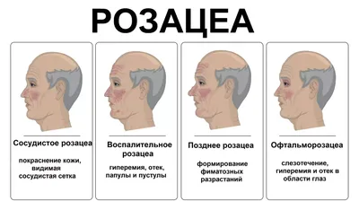 Эритема — Википедия