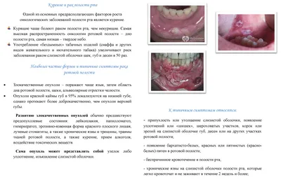 Предраковые заболевания слизистой оболочки полости рта и красной каймы губ  - презентация, доклад, проект скачать