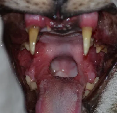 Разрастание тканей десны: Лекарства, вызывающие фиброматоз десен | Портал о  зубах Симпладент | Дзен