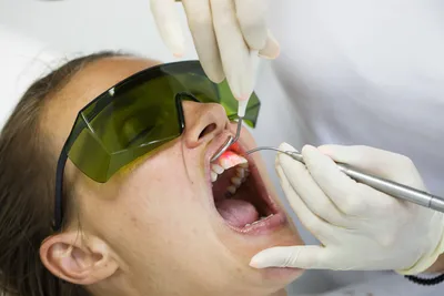 Бюгельный протез зубов в Москве, цена установки от 56 700 руб | Выхино |  ЮВАО
