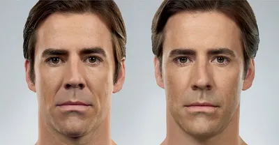 Жевательные мышцы. Как они меняют лицо и как с ними работать. Самомассаж  лица - YouTube