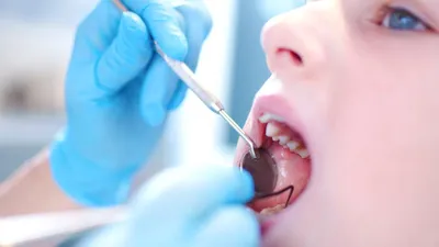 STOMWEB — Дефекты зубов у детей