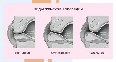 Ученые обнаружили резкое удлинение полового члена у мужчин — Сообщество  «Курилка» на DRIVE2