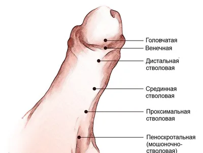 Читала в интернете — очень много разных форм гипоспадии! Нам поставили  разные диагнозы: один доктор написал венечная форма, второй —  дистально-стволовая форма! Как определить форму гипоспадии?