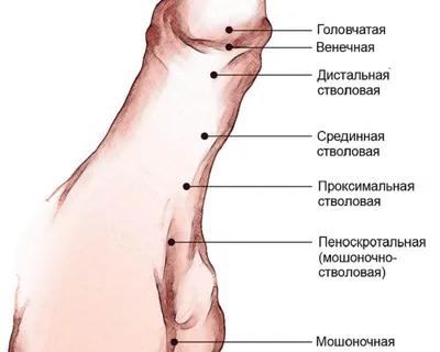 Гипоспадия венечная форма фото фото