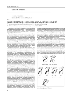 Анализ результатов хирургического лечения гипоспадии у детей за 2010 - 2015  годы – тема научной статьи по клинической медицине читайте бесплатно текст  научно-исследовательской работы в электронной библиотеке КиберЛенинка