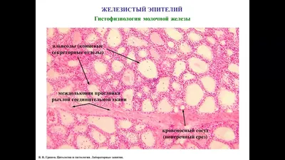 Гистологический препарат: печень свиньи. | Пикабу