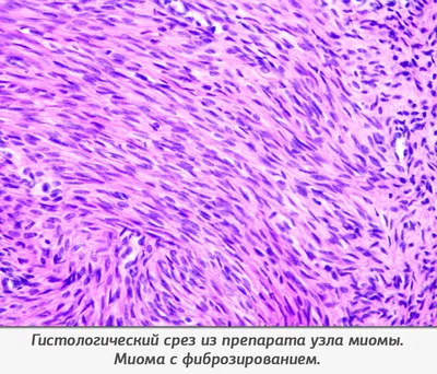 Гистологические препараты для мочевой системы, 4 шт. в комплекте, почечная  сек | AliExpress