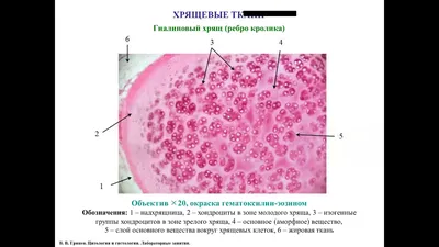 Меланома глаза у кошки | Гистология