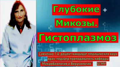 Микоз кожи стоп, ногтей, головы, рук | Лечение микоза у ребенка и взрослого  в Клинике подологии Полёт в Москве