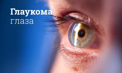 Глаукома: симптомы и лечение у взрослых - Причины возникновения и виды  глаукомы | Глаукома.ру