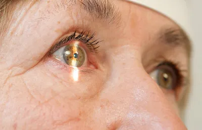 10 симптомов глаукомы у взрослых: как проявляются симптомы глаукомы и что  надо делать в домашних условиях