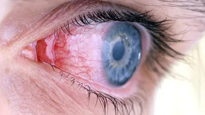 Профилактика глаукомы: как сохранить зрение | OmniusClinic | Дзен