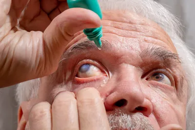 Глаукома: каждый должен знать - причины, симптомы, лечение и профилактика