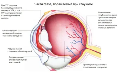 Глаукома. Диагностика и профилактика
