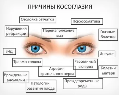 Косоглазие у детей: лечение в Самаре, цены на лечение косоглазия у детей