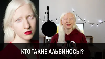 Pin on ALBINO EYES [глаза альбиноса]