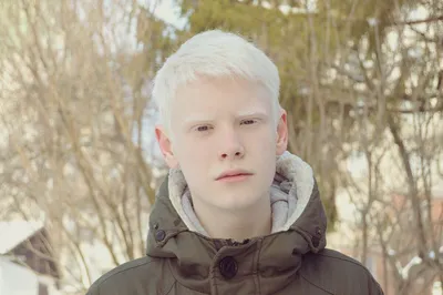 Три вопроса про людей-альбиносов, которые задают чаще всего | Мила 4 Африка  | Дзен