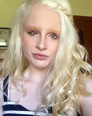 Новая «Принцесса Нибиру». Девочка-альбинос с красными глазами испугала  пользователей интернета - Рамблер/новости