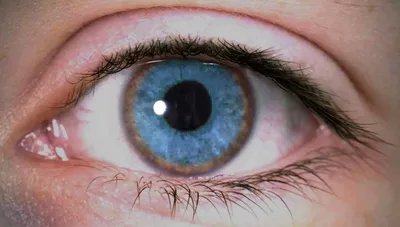 Глаукома: провоцирующие факторы, симптомы и методы лечения болезни -  Офтальмологические клиники «Эксимер» (Одесса) - диагностика и лечение  заболеваний глаз у взрослых и детей