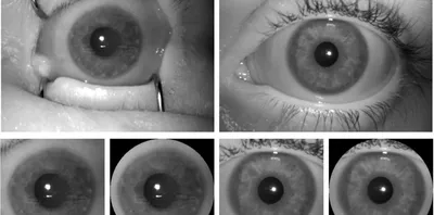 ИИ-сканер научился определять смерть по снимку глаз