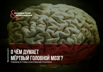 Ответы Mail.ru: Как выглядят зрачки мертвого человека?