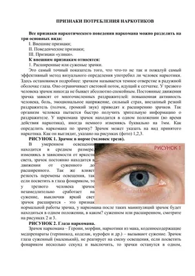Сейчас вся Россия ходит с красными глазами как у наркоманов из-за  распространения процедуры наращивания ресниц дешёвыми клеями и толстой… |  Instagram