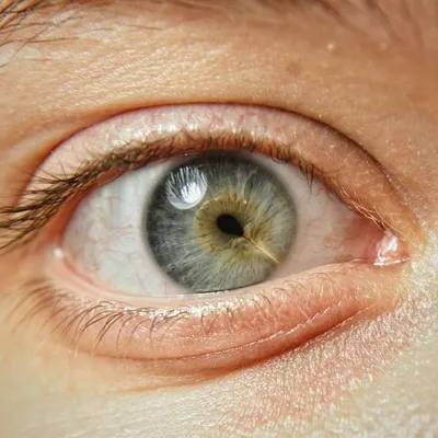 Самые странные и необычные глаза в мире — Виртуальный Кореновск