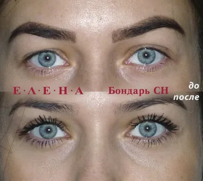 Как избежать эффекта круглых глаз после блефаропластики: советы врача - 21  июля 2020 - НГС