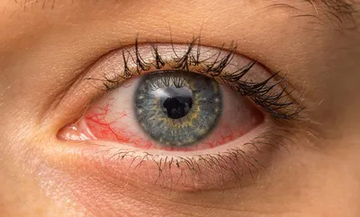 Спасение чувствительной и повреждённой кожи вокруг глаз с La Roche-Posay  Toleriane Ultra Eye Contour... Или не спасение? | Отзывы покупателей |  Косметиста