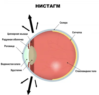Как лечить астигматизм - Центр микрохирургии глаза доктора Шаталова
