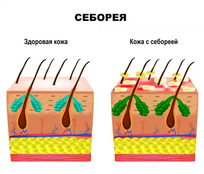 Гельминты — кто они? Чем опасны для человека?