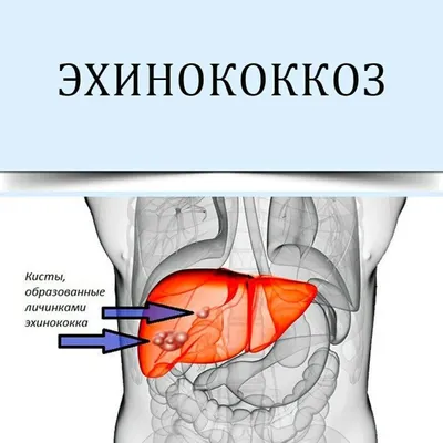 Гельминты (глисты) у уток и гусей: виды, симптомы, лечение, профилактика |  Агропромышленный вестник